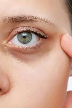 Dark Spots