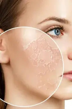 Dry Skin Beausial