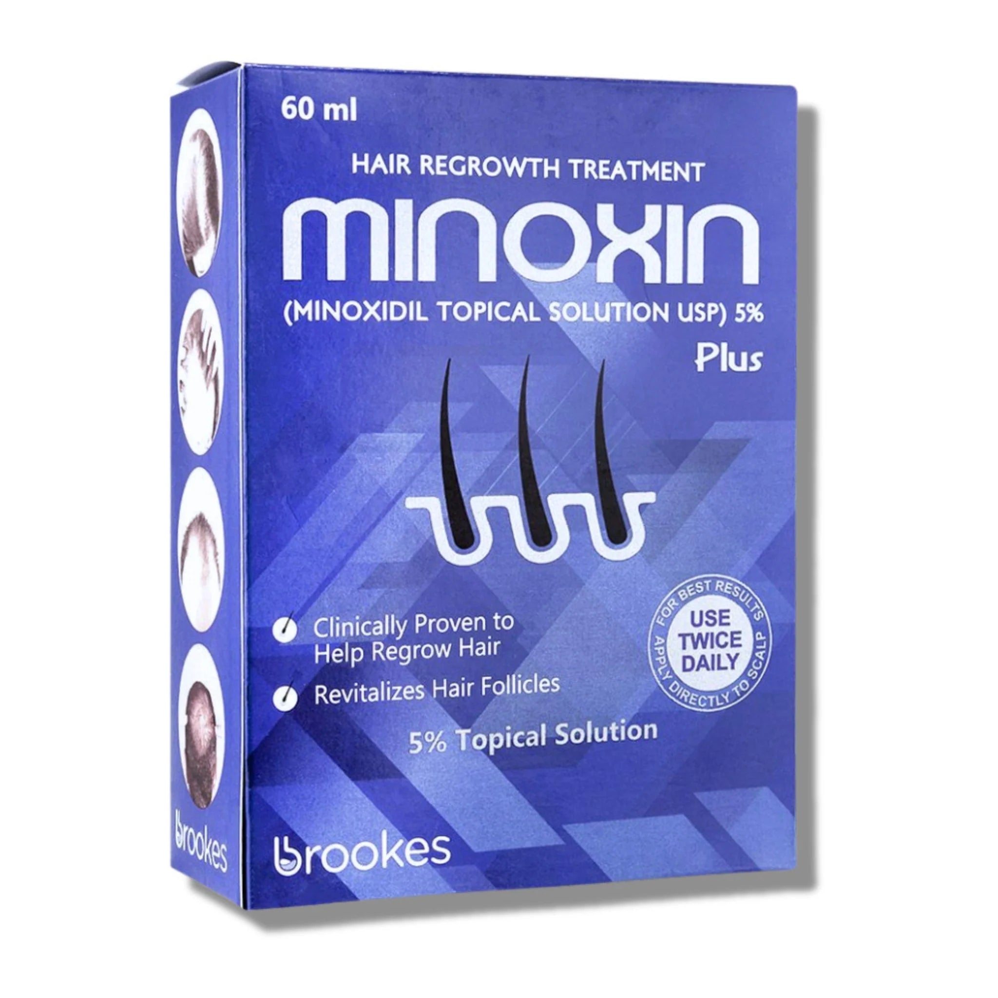 Minoxin 5% Minoxidil Hair Regrowth Spray 60ml