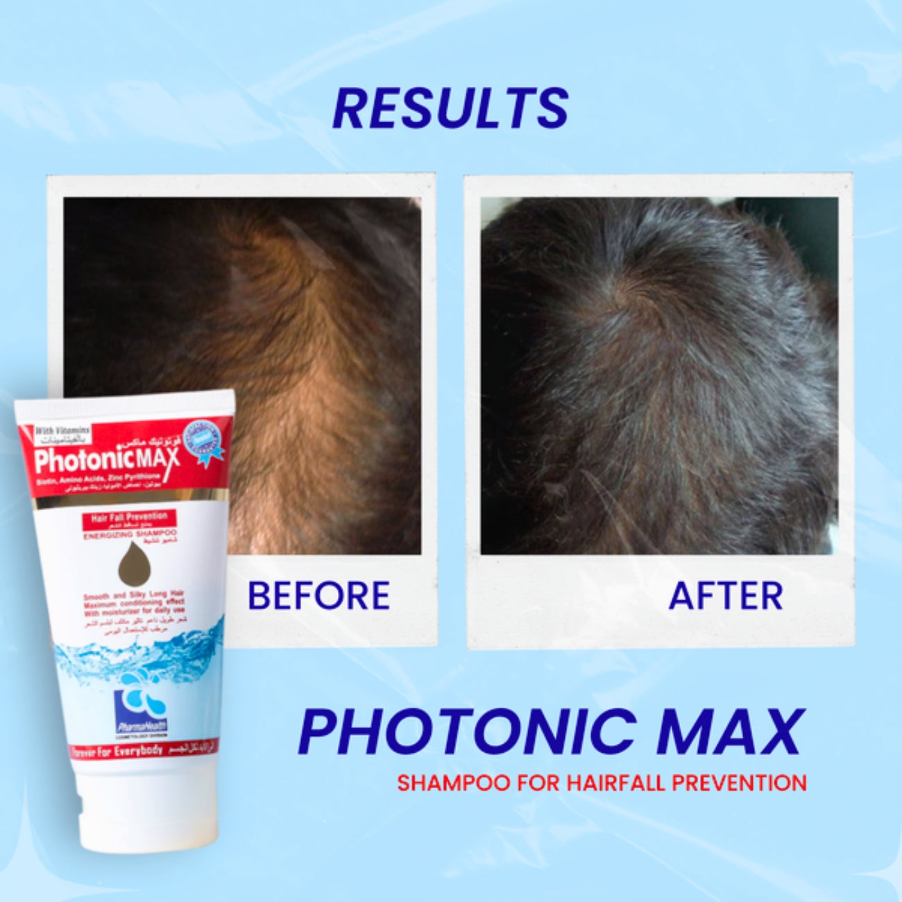 Photonic MAX Shampoo for Hairfall Prevention 120ml