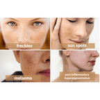 Clobevate Cream 20g Dark Spot & Dark Circle Remover