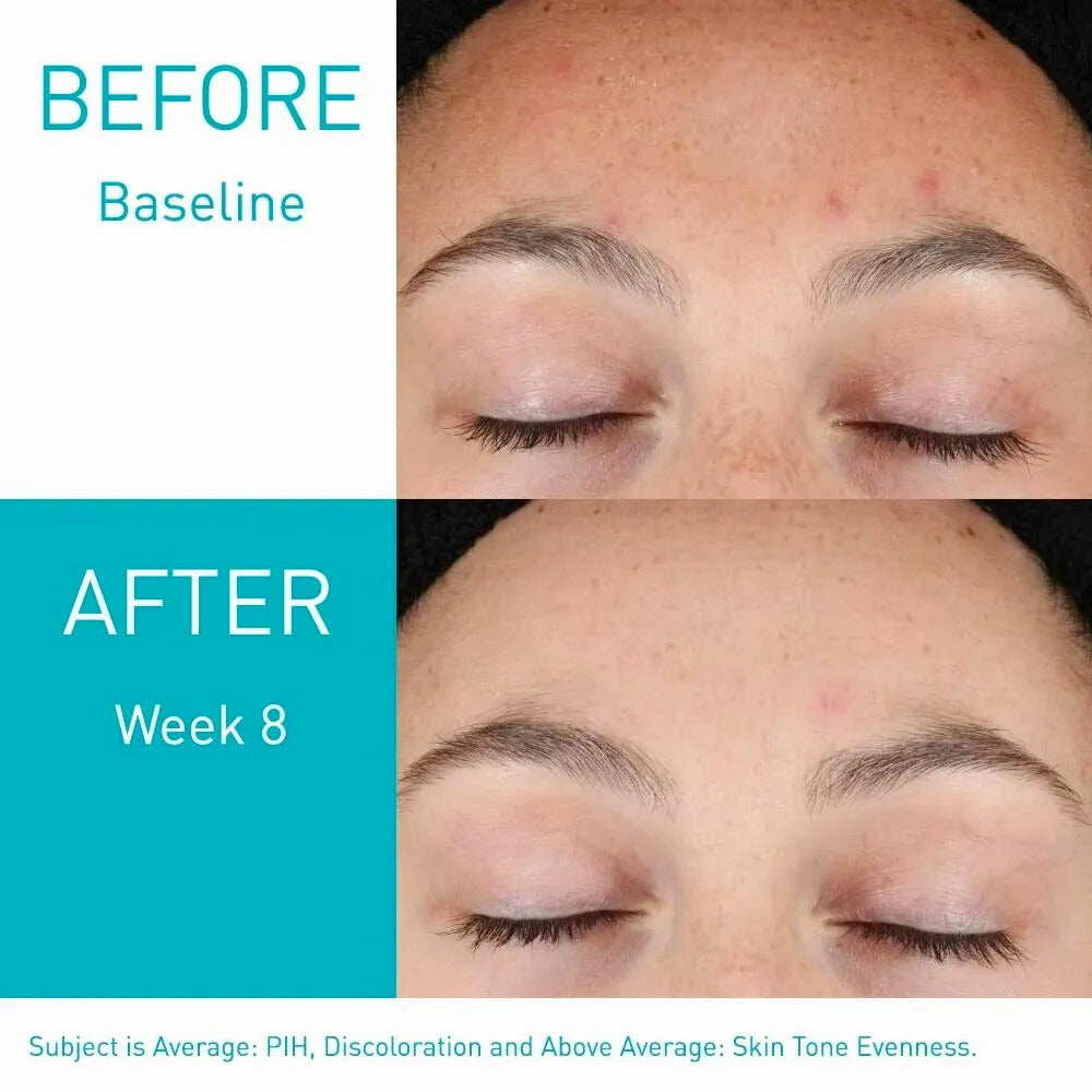 CeraVe Resurfacing Retinol Serum 30ml