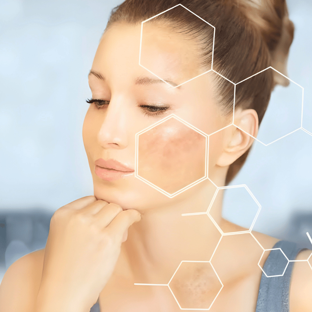 Clobevate Cream 20g Dark Spot & Dark Circle Remover