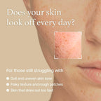 I’m From Rice Toner 150ml