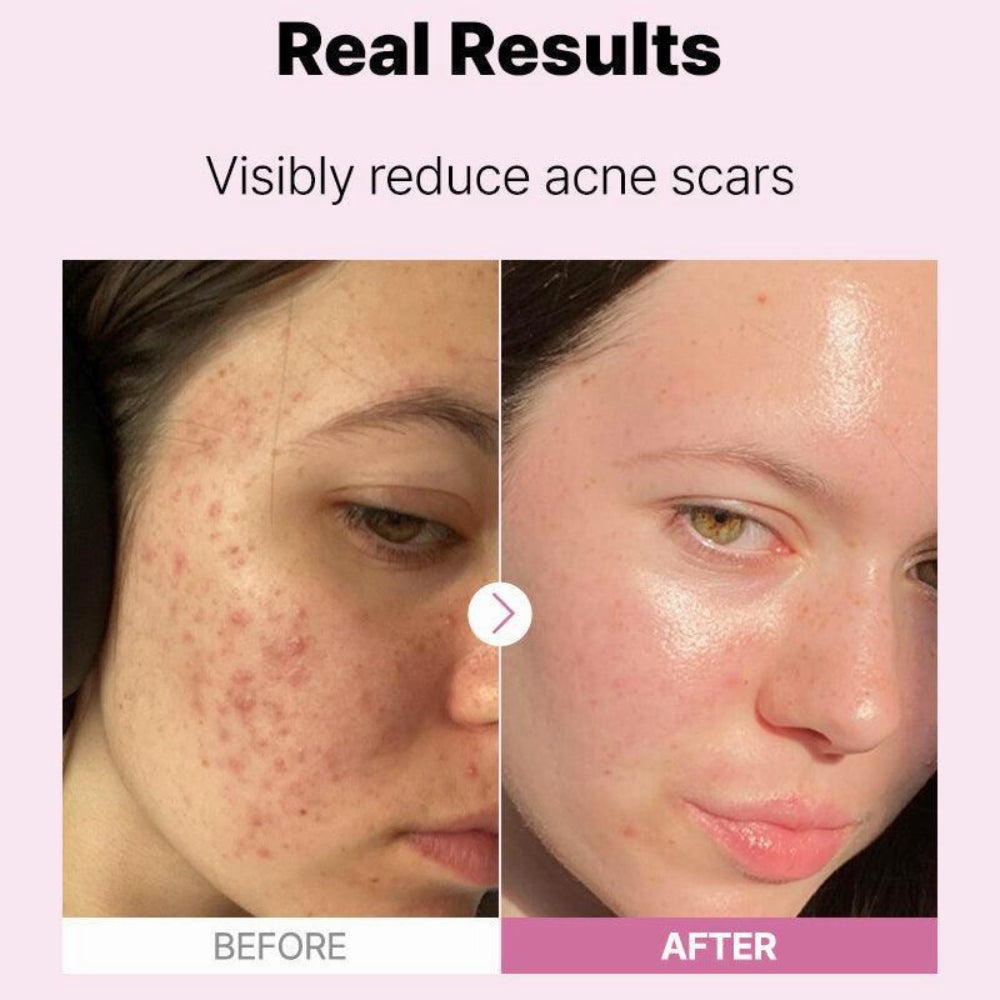 Cosrx The Niacinamide 15 Serum 20ml