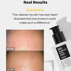Cosrx BHA Blackhead Power Liquid 100ml