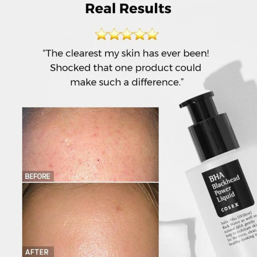 Cosrx BHA Blackhead Power Liquid 100ml