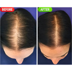 Minoxin 5% Minoxidil Hair Regrowth Spray 60ml