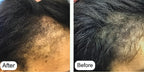 Minoxin 5% Minoxidil Hair Regrowth Spray 60ml