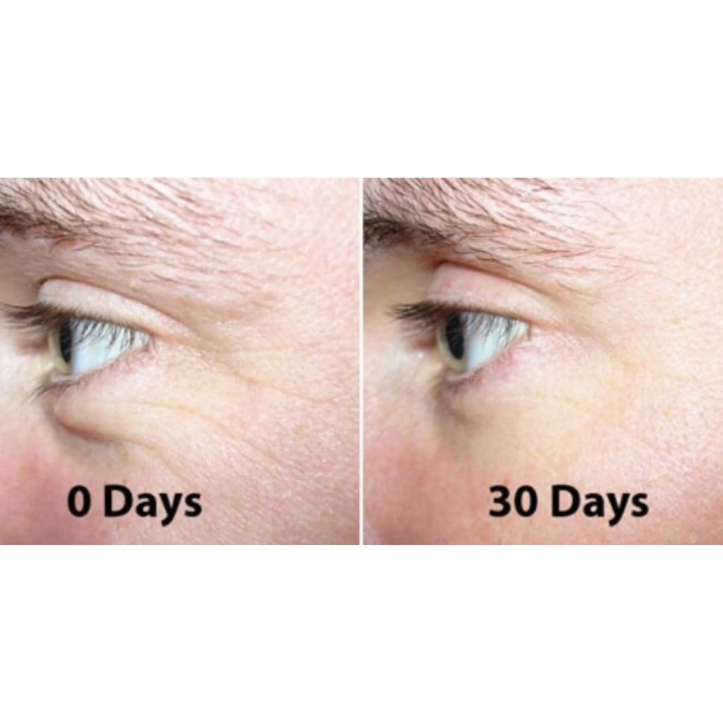 The Ordinary Argireline Solution 10% 30ml