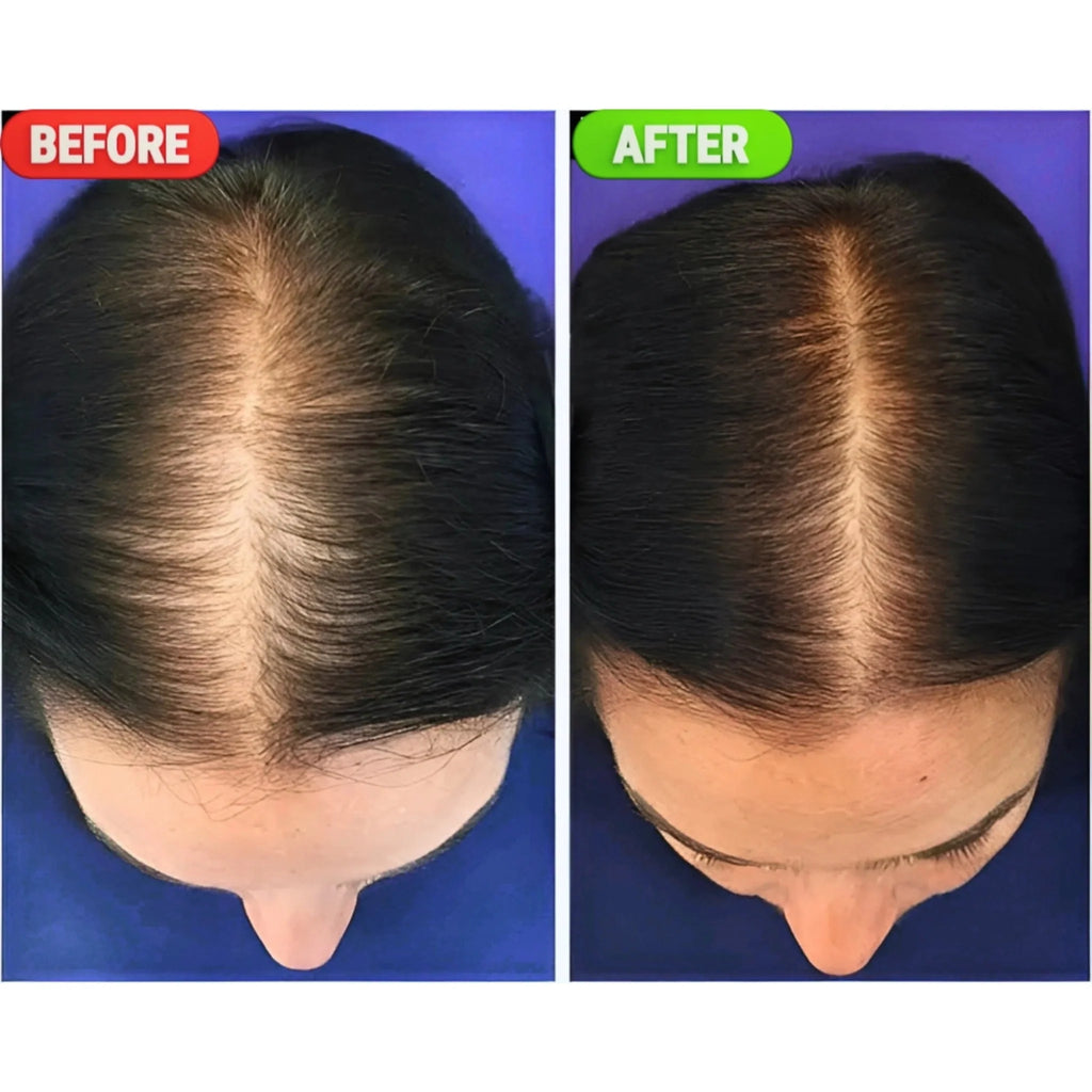 Minoxin 5% Minoxidil Hair Regrowth Spray 60ml