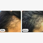 Minoxin 5% Minoxidil Hair Regrowth Spray 60ml