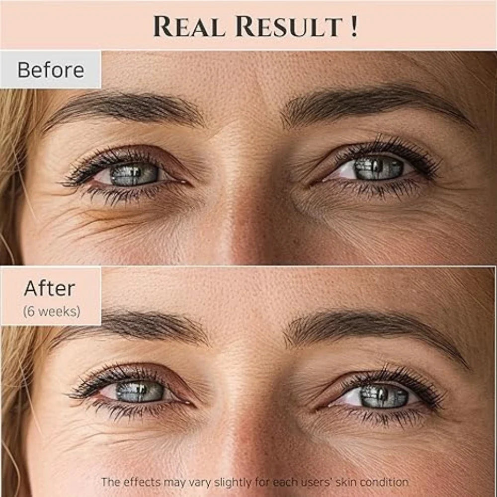 Lightweight under eye serum for Pakistan heat and humidity