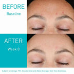 CeraVe Resurfacing Retinol Serum 30ml