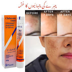 Clobevate Cream 20g Dark Spot & Dark Circle Remover