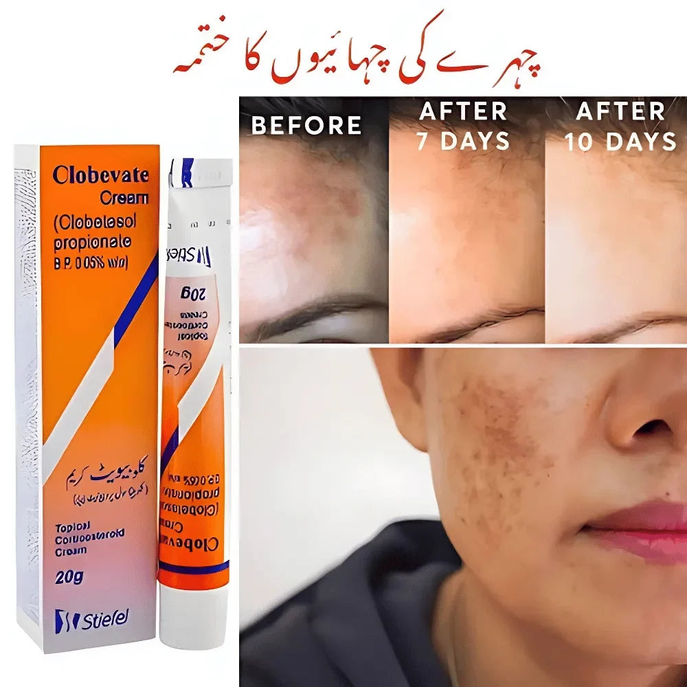 Clobevate Cream 20g Dark Spot & Dark Circle Remover Clobevate