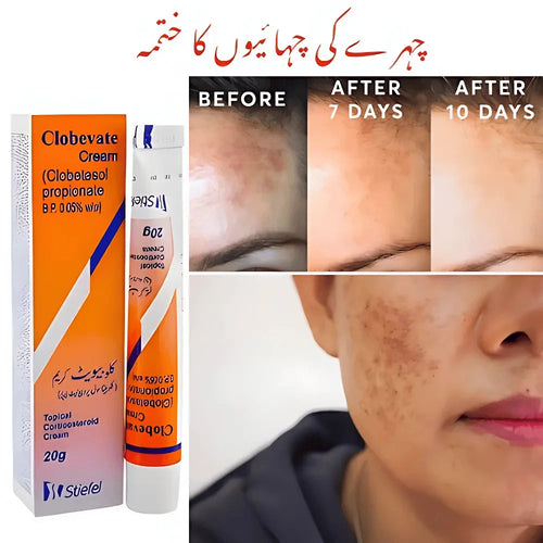 Clobevate Cream 20g Dark Spot & Dark Circle Remover Clobevate