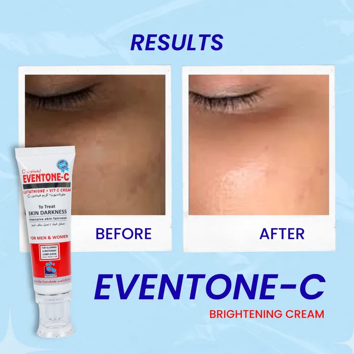 PharmaHealth Eventone C vitamin C brightening cream available in Pakistan