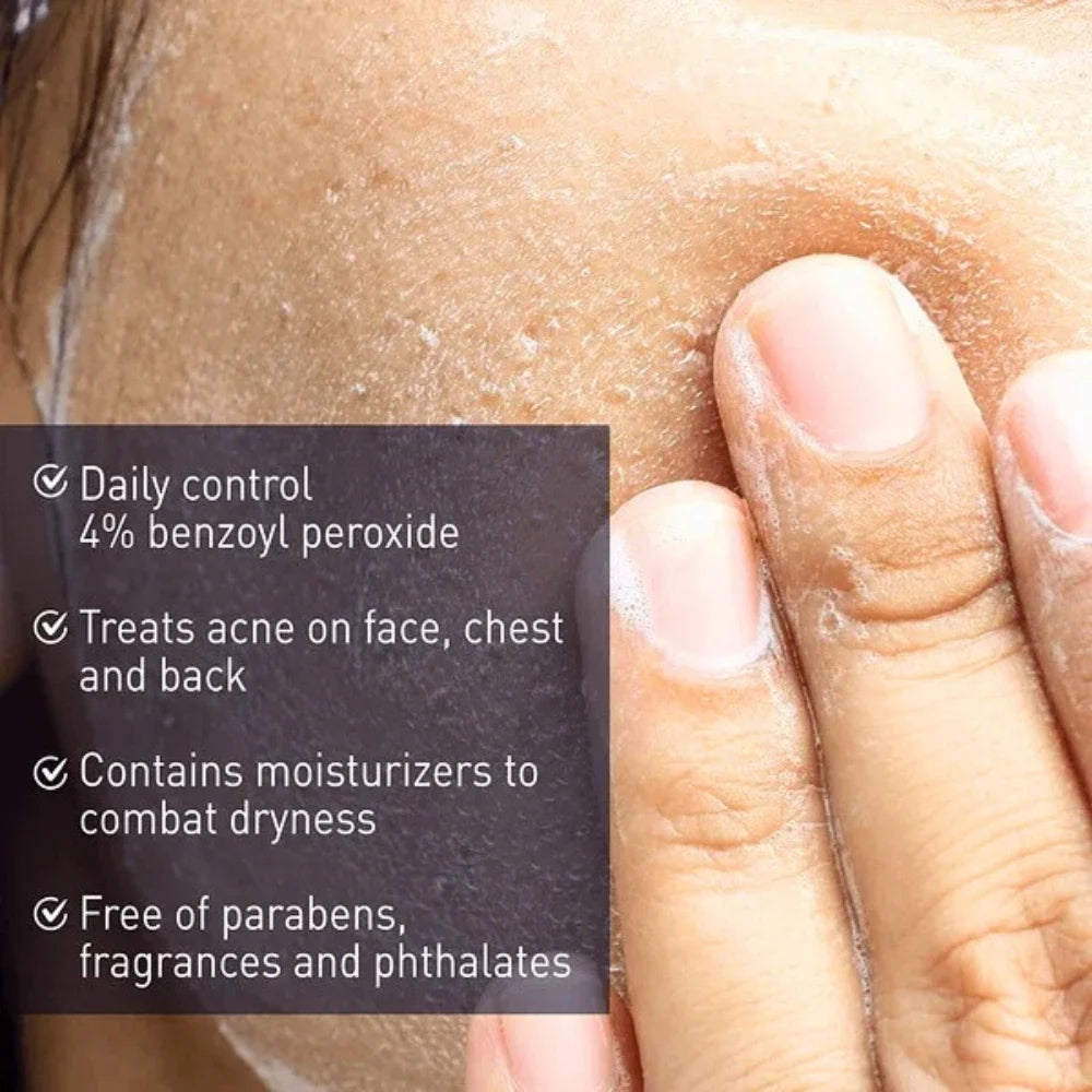 PanOxyl Acne Creamy Wash 4% Daily Control 170g PanOxyl