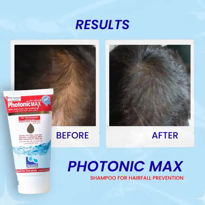 Original Photonic MAX Shampoo 120ml with box and tube