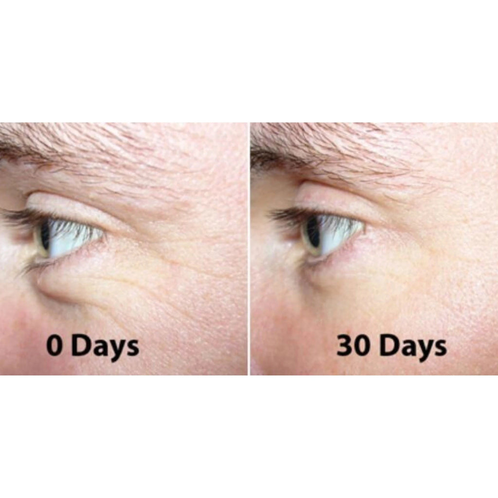 The Ordinary Argireline Solution 10% 30ml